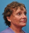 Facelift