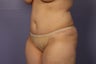 39 yr old Mommoy Makeover