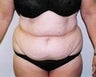43 year old female patient 