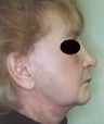 68 year old female patient 