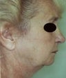 68 year old female patient 
