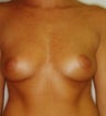 29 year old female patient 