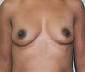 36 year old female patient 
