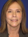 Facelift/Necklift combined with Facial Fat Grafting