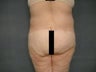 Age: 53 , Height: 5"5", Weight: 200lbs.