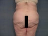 Age: 53 , Height: 5"5", Weight: 200lbs.