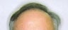 47 year old male patient 