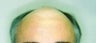 47 year old male patient 