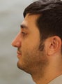 Rhinoplasty