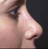 nose