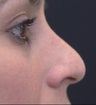 nose