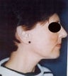 46 year old female patient 
