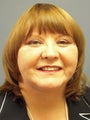 Brow Lift on 62-year-old