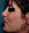 33 year old female patient 
