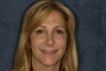 Porcelain Veneers to Correct Chipped, Worn, and Discolored Teeth