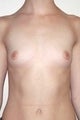 29 year old female patient