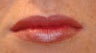 Juvederm for Lips