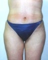 28 year old female patient 