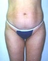 28 year old female patient 