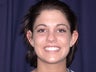Otoplasty