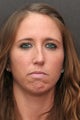 30 Year Old Young Lady Treated with Botox for the Creases of her chin