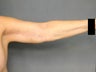 Age: 62, Height: 5"4", Weight: 161lbs.