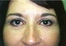 53 year old female patient 