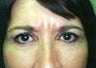 53 year old female patient 