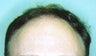 44 year old male patient 