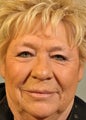 Eyelids causing vision difficulties