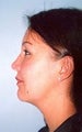 33 year old female patient 