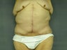 Age: 57, Height: 5"6", Weight: 256lbs.