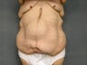Age: 57, Height: 5"6", Weight: 256lbs.