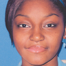 African American Rhinoplasty