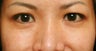 Crows feet