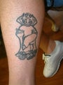 Tattoo Removal