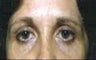 36 year old female patient 