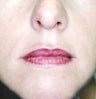 36 year old female patient 