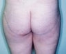 33 year old female patient 