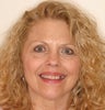 60 Year Old Female Treated for Missing Teeth
