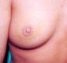34 year old female patient 