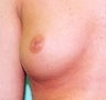 34 year old female patient 
