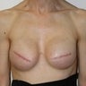 48 year old female patient 