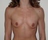 29 year old female patient