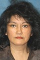 Women's Face Lift