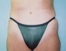 31 year old female patient 