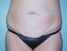31 year old female patient 