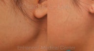 Jaw