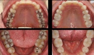 Cosmetic Dentistry