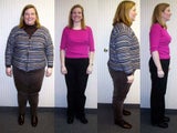 Gastric Bypass